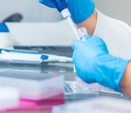 Análisis cinéticos, conformacionales y de autoagregación en proteínas en espacios confinados. Encapsulamiento de enzimas en geles y nanopartículas de silicato.jpg